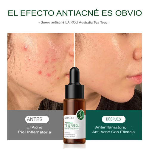 LAIKOU Suero Antiacné de Árbol de Té — Controla Grasa, Calma y Reduce Imperfecciones